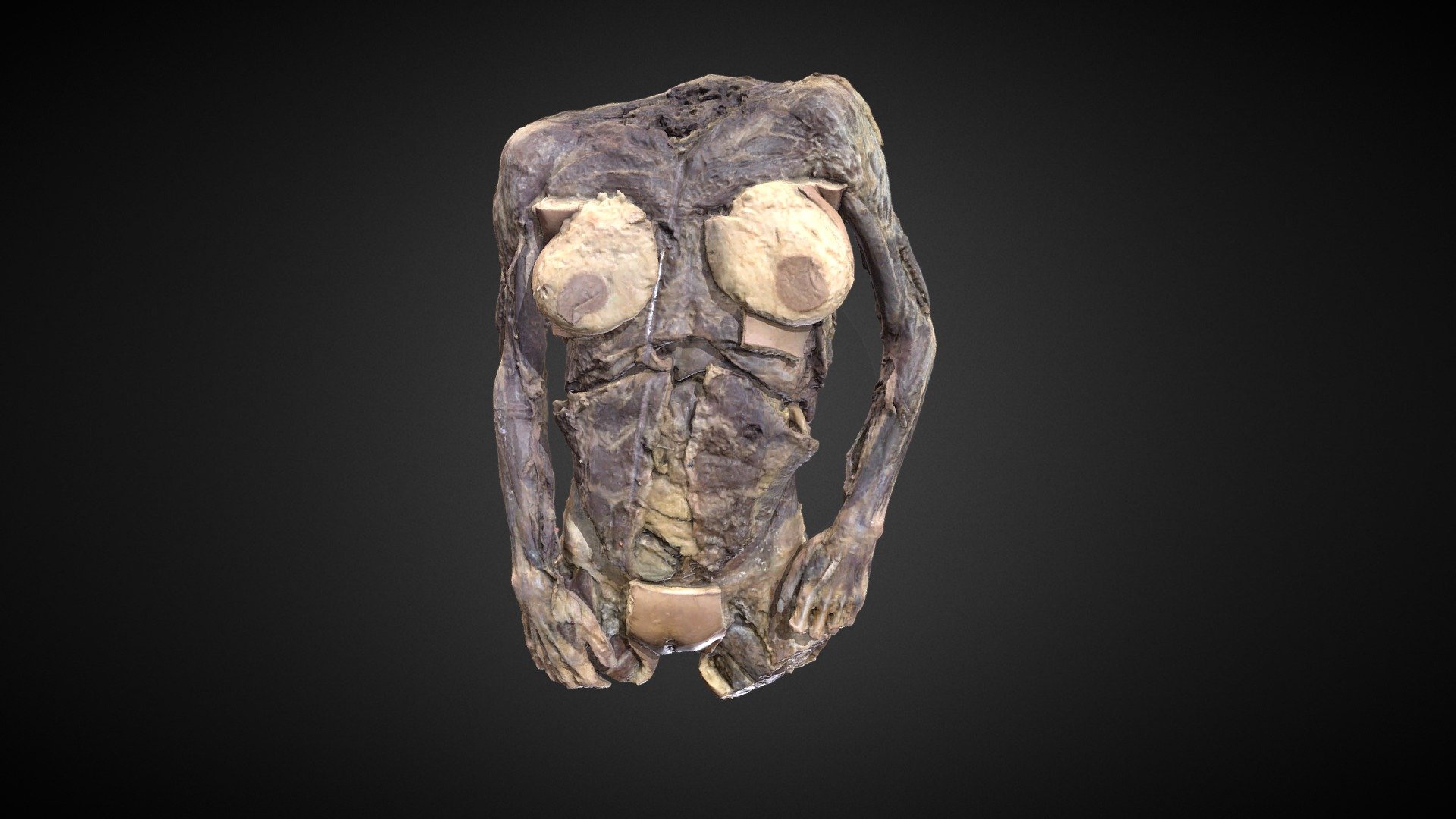 Modelo diseccionado del tronco de mujer en el cual se pueden observar diferentes segmentos, incluyendo la cara anterior y posterior. Es un cadáver del laboratorio de anatomía humana de la Universidad Austral de Chile. La disección estuvo a cargo de la Profesora Patricia Hernández, en tanto, que el escaneo, enmallafo, texturizado y simplicador por el Prof. MCs. Gonzalo Tiznado Matzner. 

Dissected model of the woman's trunk, it can be observed in all angles, including the anterior and posterior aspect. It is a corpse from the human anatomy laboratory of the Austral University of Chile. The dissection was made by Professor Patricia Hernández, while the scanning, meshing, texturing and simplifying by Prof. MCs. Gonzalo Tiznado Matzner.

Puedes ver más muestras en: https://anatomiahumana3d.com
You can watch more 3D samples on: https://3dhumananatomy.org

You can download the files in High Quality in STL and PLY (with real colors) formats. This will help us to continue our work 3d model