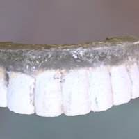 GWs False Teeth