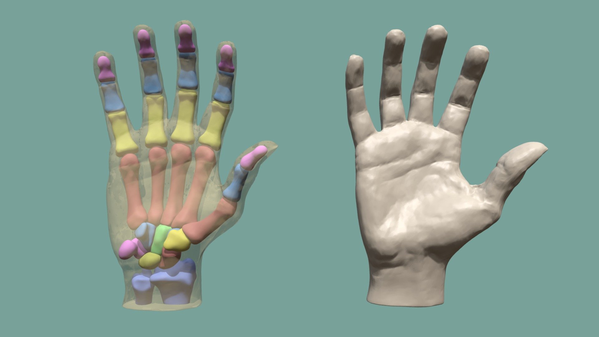 This hand sculpt is shown along side the bones of the hand to help you get an understanding of the main forms of the hand and understand how the bones contribute to the hand's over all shape.

To get the most from this turntable Find a view that you are intrested in and let the animation play or scrub through it yourself  to rotate the hands and compare the structures.

The bones of the fingers are colour coded by type:


pink - distal phalanges
blue - middle phlanges
yellow - proximal phlanges
red - metacarpals

The carpals are coloured  randomly so as they can be differentiated, with the ulna and radius in blue below them. 

I made this sculpt as part of a tutorial I am doing on the anatomy of th hand, once it is done I will be posting  it up on my website 3d model