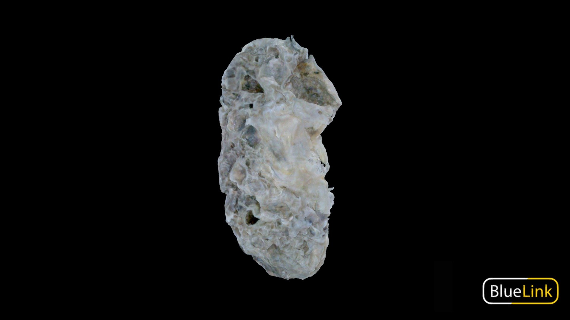 Human polycystic kidney
Captured with: Einscan Pro
Captured by: Will Gribbin
Edited by: Cristina Prall
University of Michigan - Polycystic Kidney - 3D model by Bluelink Anatomy - University of Michigan (@bluelinkanatomy) 3d model