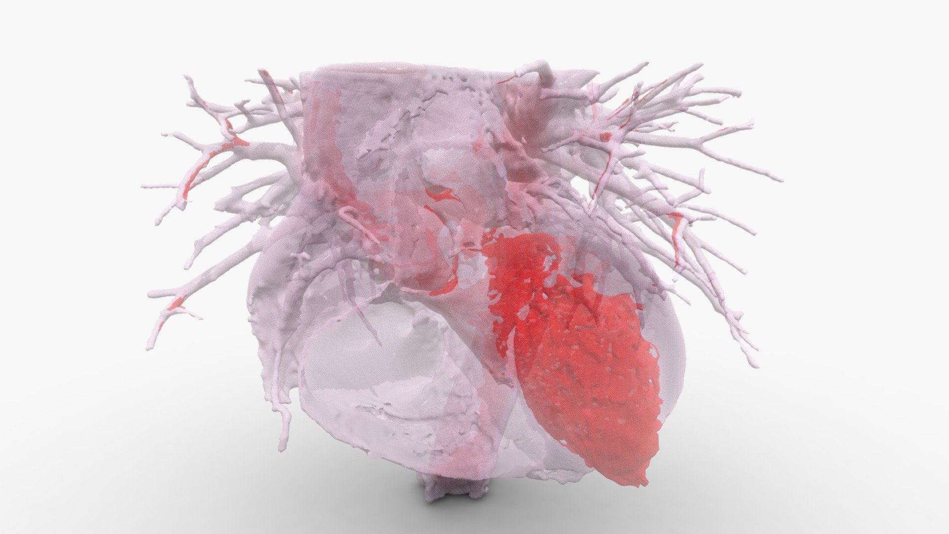 3D heart tissue and blood volume from Cardiac ECG-gated CT. Data set