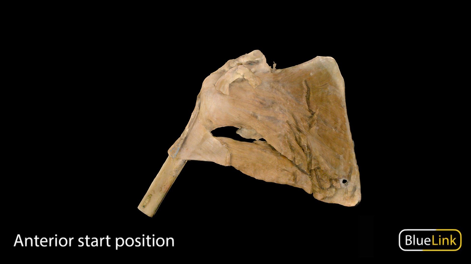 3D scan of the rotator cuff 

Captured with Einscan Pro

Captured and edited by: Will Gribbin

Copyright2019 BK Alsup &amp; GM Fox

ID 29790-U04 - Rotator Cuff - 3D model by Bluelink Anatomy - University of Michigan (@bluelinkanatomy) 3d model