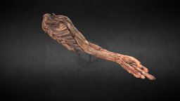 M. superior con nervios/ Upper limb with nerves shoulder, nerve, hombro, nerves, plexo_braquial, nervios, upper_limb, miembro_superior, ulnar_nerve, nervio_ulnar, nervio_mediano, median_nerve, arteria_brachial, arteria_braquial, brachial_plexus, nervio