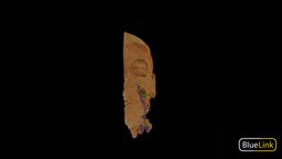 Muscles of Mastication head, human