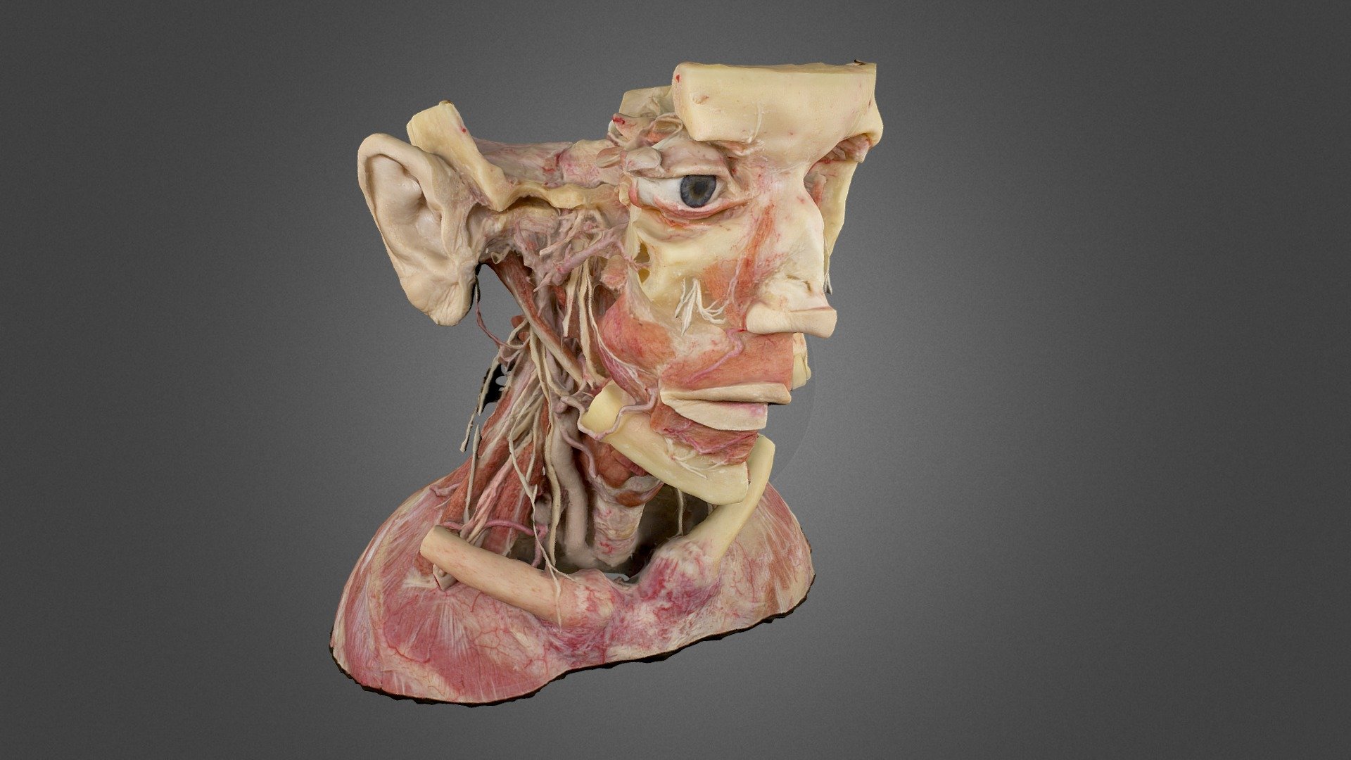 photogrammetry using canon eos m, 24mm, foldio 360 - plastination 002 hi-res 2 chunks, mild mesh - 3D model by ScienceLifeNY 3d model