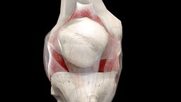 Impingement of Fat Pad school, red, cap, library, university, patient, knee, bone, med, fat, leg, sports, indiana, pad, thigh, hospital, athlete, medicine, health, athletic, iu, syndrome, inflamed, iupui, ligament, injury, ligaments, swollen, medical, sport, bones, kneecap, msk, impingement, hoffa