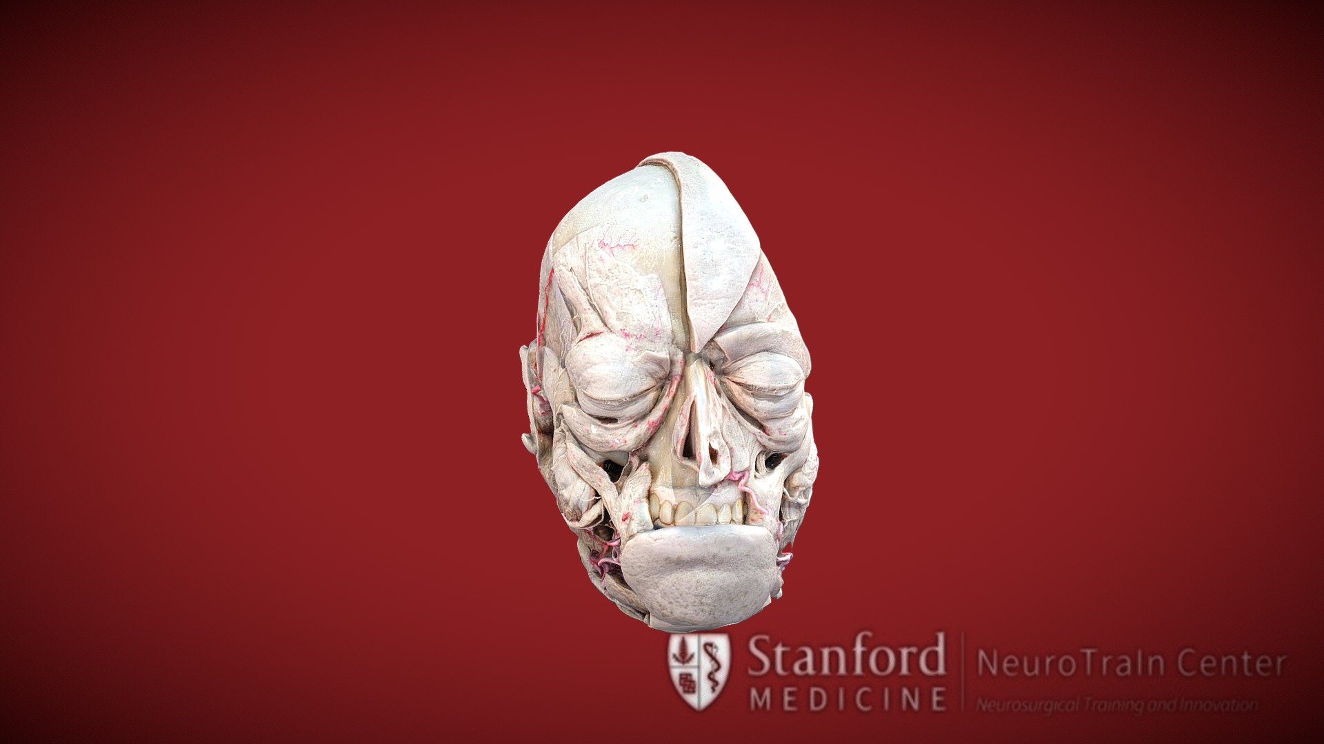 Hypotalamic nuclei - 3D model by vv (@verav) 3d model
