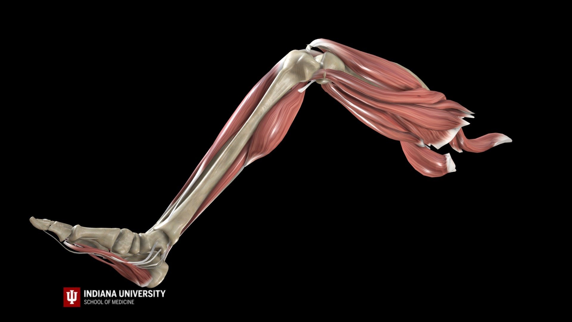 The anterior drawer test is a physical examination doctors use to test the stability of the knee's anterior cruciate ligament (ACL). Doctors may use this test, along with images and other exams, to determine if a person has injured their ACL and recommend treatment options.

©Indiana University Board of Trustees. This project was funded by a grant from the Indiana University School of Medicine Program to Launch those Underrepresented in Medicine toward Success (PLUS) and the Medical Student Education Division of the Indiana University School of Medicine, Department of Family Medicine. 3D imaging created by Luke Parker and Emma Parker 3d model